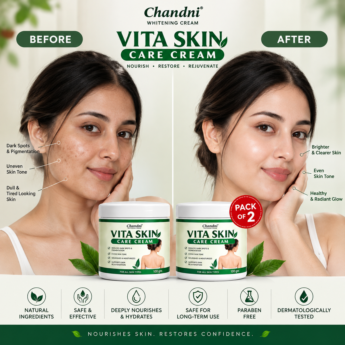 VITILIGO Skin Care Cream  Pack Of 2