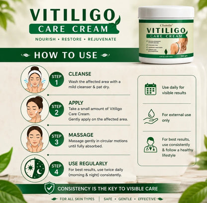 VITILIGO Care Cream (Buy 1 Get 1 FREE)